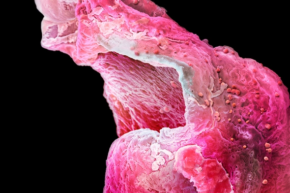 High resolution picture of an artificial heart muscle from a research lab in Cambridge.