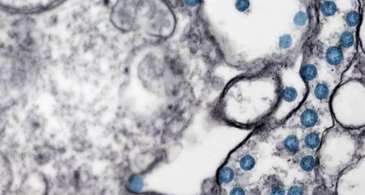 Transmission electron microscopic image of an isolate from a case of coronavirus disease (COVID-19)