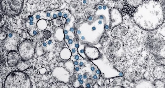 covid 10 grey image_0