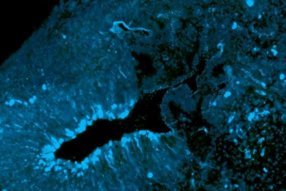 Makrokuva aivo-organoidista